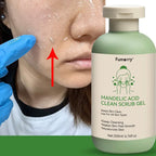 Zenora Deep Cleansing Exfoliating Gel 200ml