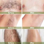 Zenora Olive Oil Wax Strip Hair Removal Set